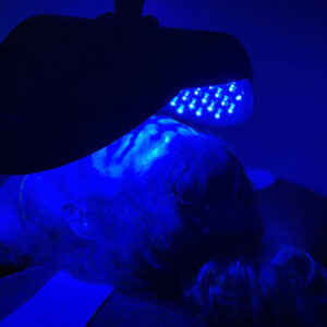 Blue Light Therapy