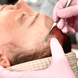 Esthetics Student Dermaplaning Training